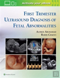 Bertrand.pt - First Trimester Ultrasound Diagnosis Of Fetal Abnormalities