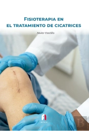 Fisioterapia En El Tratamiento De Cicatrices