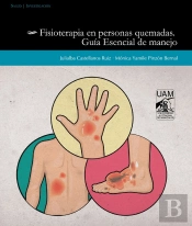 Fisioterapia En Personas Quemadas