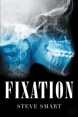 Bertrand.pt - Fixation