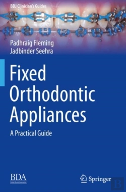 Bertrand.pt - Fixed Orthodontic Appliances