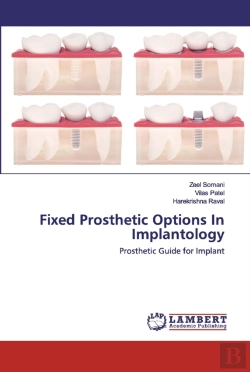 Bertrand.pt - Fixed Prosthetic Options In Implantology