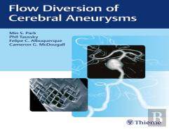 Flow Diversion Of Cerebral Aneurysms