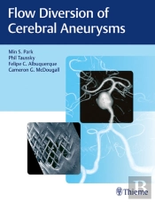 Flow Diversion Of Cerebral Aneurysms