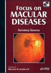 Focus On Macular Diseases