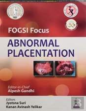 Fogsi Focus Abnormal Placentation