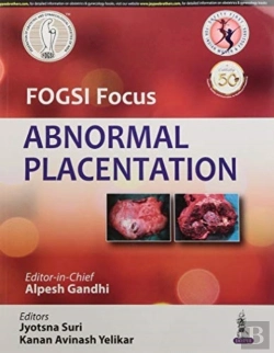 Bertrand.pt - Fogsi Focus Abnormal Placentation