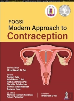 Bertrand.pt - Fogsi: Modern Approach To Contraception