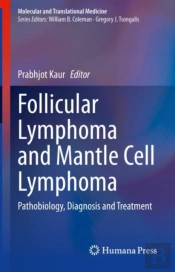 Follicular Lymphoma And Mantle Cell Lymphoma