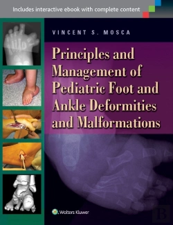 Bertrand.pt - Foot Deformities And Malformations In Children And Adolescents