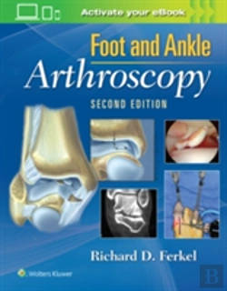 Bertrand.pt - Foot & Ankle Arthroscopy
