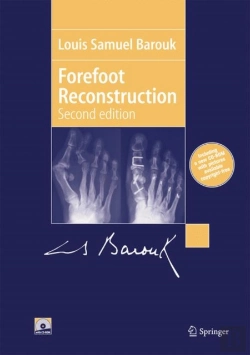 Bertrand.pt - Forefoot Reconstruction