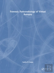 Forensic Pathoradiology Of Virtual Autopsy