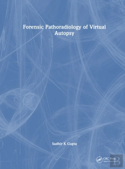 Bertrand.pt - Forensic Pathoradiology Of Virtual Autopsy