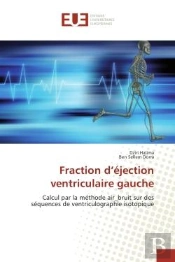 Fraction D'Ejection Ventriculaire Gauche - Calcul Par La Methode Air_Bruit Sur Des Sequences De Vent