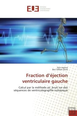 Bertrand.pt - Fraction D'Ejection Ventriculaire Gauche - Calcul Par La Methode Air_Bruit Sur Des Sequences De Vent