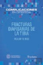Fracturas Diafisarias De La Tibia