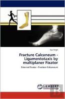 Fracture Calcaneum - Ligamentotaxis By Multiplaner Fixator