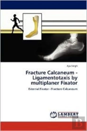 Fracture Calcaneum - Ligamentotaxis By Multiplaner Fixator