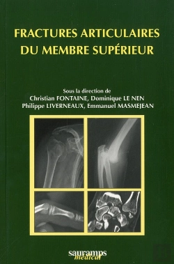 Bertrand.pt - Fractures Articulaires Du Membre Supérieur