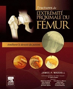 Bertrand.pt - Fractures De L'Extremite Proximale Du Femur