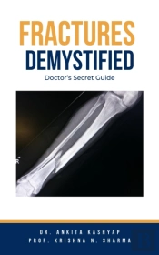 Fractures Demystified: Doctor'S Secret Guide