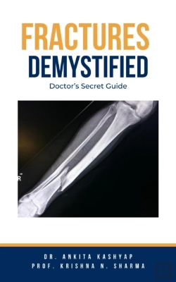 Bertrand.pt - Fractures Demystified: Doctor'S Secret Guide