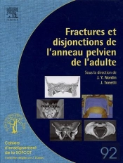Fractures Et Disjonctions De L'Anneau Pelvien De L'Adulte
