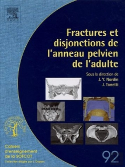 Bertrand.pt - Fractures Et Disjonctions De L'Anneau Pelvien De L'Adulte