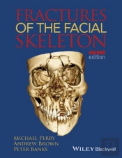 Fractures Of The Facial Skeleton