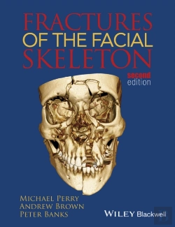 Bertrand.pt - Fractures Of The Facial Skeleton