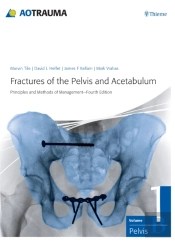 Fractures Of The Pelvis And Acetabulum (Ao)
