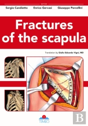 Fractures Of The Scapula