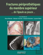Fractures Périprothétiques Du Membre Supérieur... De L'Épaule Au Pouce...