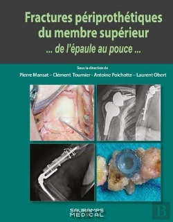 Bertrand.pt - Fractures Périprothétiques Du Membre Supérieur... De L'Épaule Au Pouce...