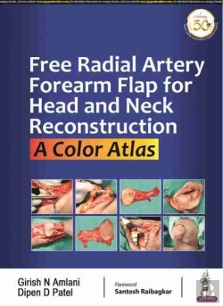 Bertrand.pt - Free Radial Artery Forearm Flap For Head And Neck Reconstruction