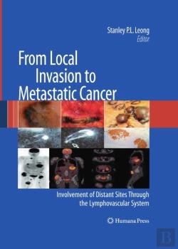 Bertrand.pt - From Local Invasion To Metastatic Cancer