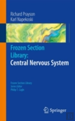 Bertrand.pt - Frozen Section Library: Central Nervous System