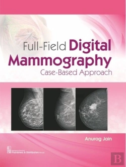 Bertrand.pt - Full-Field Digital Mammography