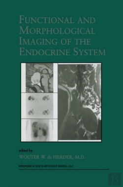 Bertrand.pt - Functional And Morphological Imaging Of The Endocrine System