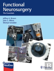 Functional Neurosurgery
