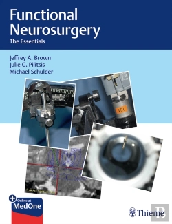Bertrand.pt - Functional Neurosurgery