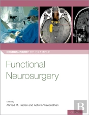 Functional Neurosurgery