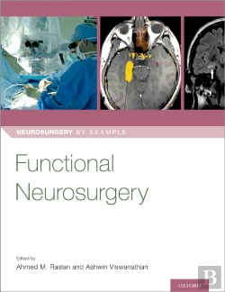 Bertrand.pt - Functional Neurosurgery