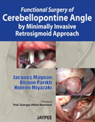 Functional Surgery Of Cerebellopontine Angle By Minimally Invasive Retrosigmoid Approach