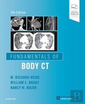 Fundamentals Of Body Ct