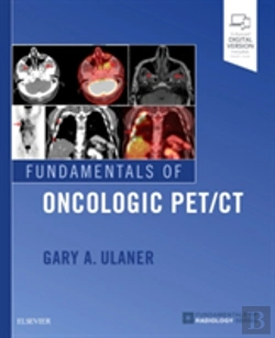 Bertrand.pt - Fundamentals Of Oncologic Pet/Ct