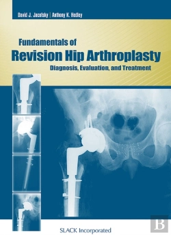 Bertrand.pt - Fundamentals Of Revision Hip Arthroplasty