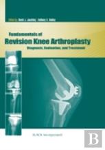 Fundamentals Of Revision Knee Arthroplasty