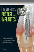 Fundamentos da Prótese Sobre Implantes